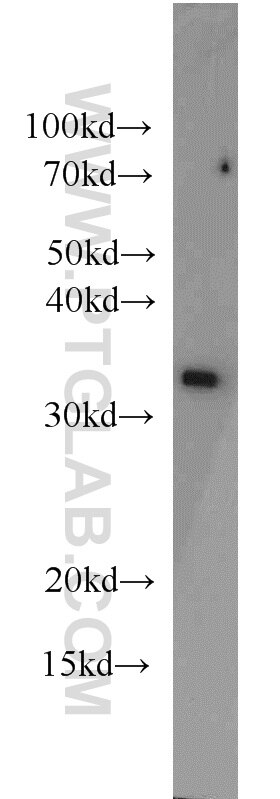 Western Blot (WB) analysis of PC-3 cells using PSMA1 Polyclonal antibody (11175-1-AP)