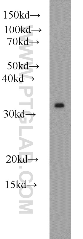 Western Blot (WB) analysis of COLO 320 cells using PSMA1 Polyclonal antibody (11175-1-AP)