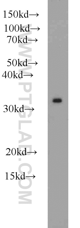 WB analysis of COLO 320 using 11175-1-AP