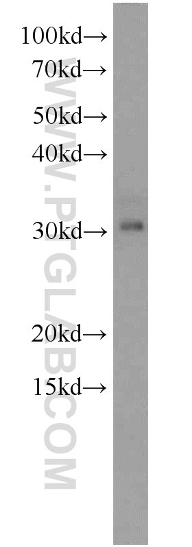 Western Blot (WB) analysis of mouse kidney tissue using PSMA1 Polyclonal antibody (11175-1-AP)