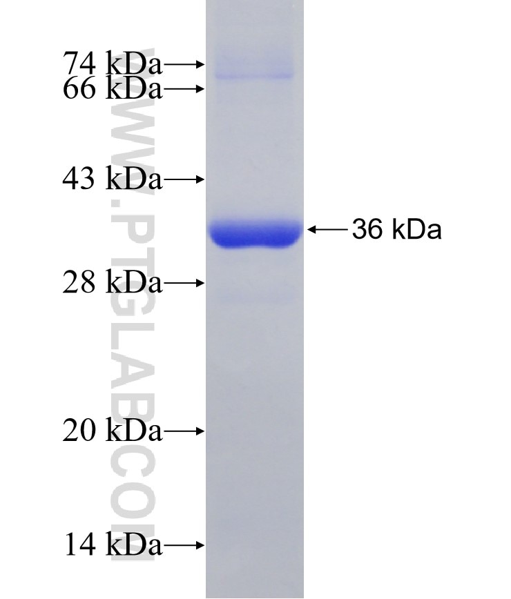 PSMA1 fusion protein Ag30527 SDS-PAGE