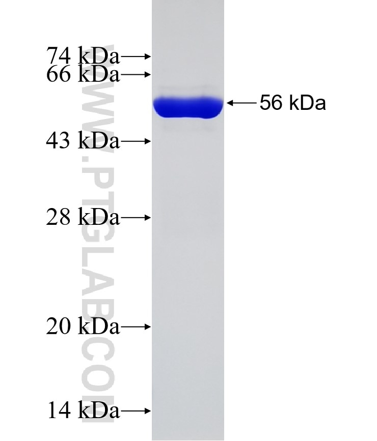 PSMA1 fusion protein Ag1660 SDS-PAGE