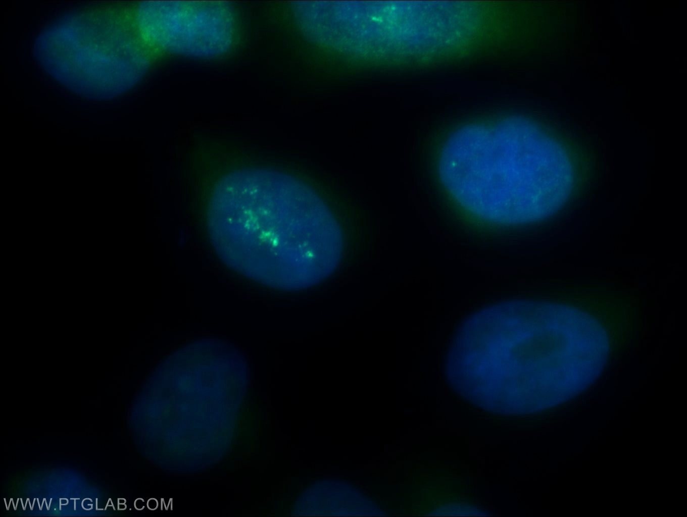 Immunofluorescence (IF) / fluorescent staining of HepG2 cells using PSMA2 Polyclonal antibody (14377-1-AP)