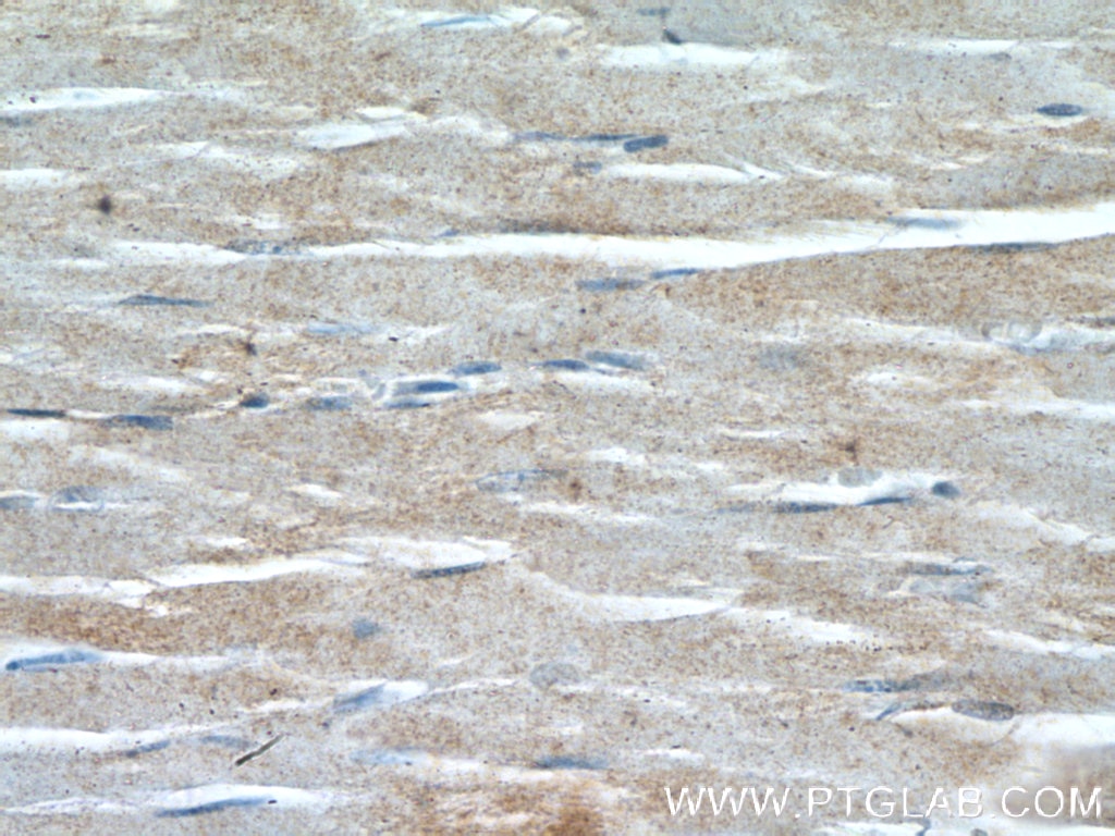 Immunohistochemistry (IHC) staining of human skeletal muscle tissue using PSMA2 Polyclonal antibody (14377-1-AP)