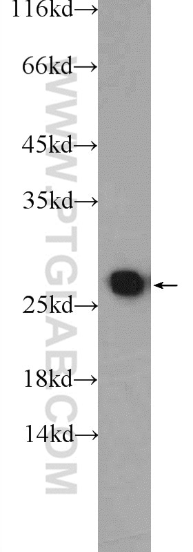 Western Blot (WB) analysis of mouse kidney tissue using PSMA2 Polyclonal antibody (14377-1-AP)