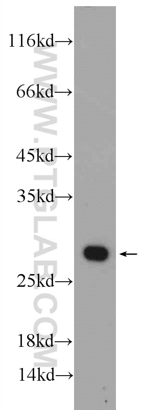Western Blot (WB) analysis of HEK-293 cells using PSMA2 Polyclonal antibody (14377-1-AP)
