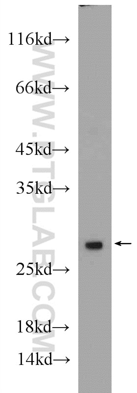 Western Blot (WB) analysis of HEK-293 cells using PSMA2 Polyclonal antibody (14377-1-AP)