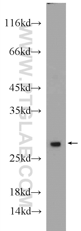 WB analysis of HEK-293 using 14377-1-AP