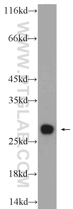 Western Blot (WB) analysis of HepG2 cells using PSMA2 Polyclonal antibody (14377-1-AP)