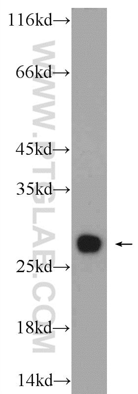 WB analysis of HepG2 using 14377-1-AP