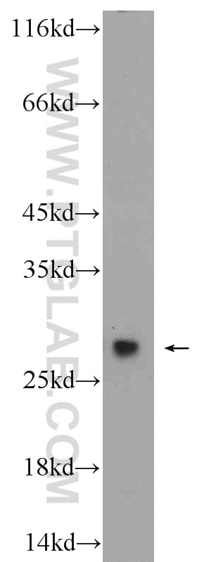 Western Blot (WB) analysis of HepG2 cells using PSMA2 Polyclonal antibody (14377-1-AP)