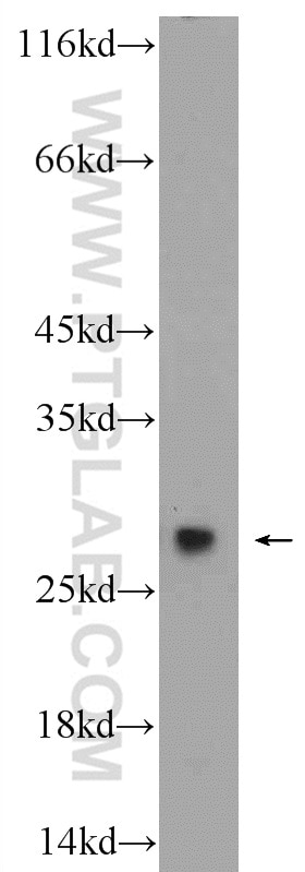 WB analysis of HepG2 using 14377-1-AP