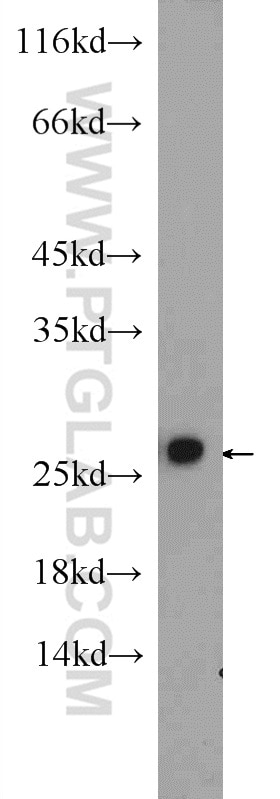 Western Blot (WB) analysis of NIH/3T3 cells using PSMA2 Polyclonal antibody (14377-1-AP)