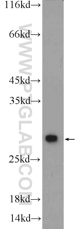 Western Blot (WB) analysis of PC-3 cells using PSMA2 Polyclonal antibody (14377-1-AP)