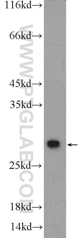 WB analysis of PC-3 using 14377-1-AP