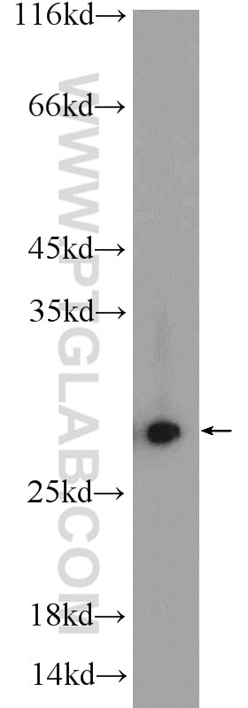 Western Blot (WB) analysis of PC-3 cells using PSMA2 Polyclonal antibody (14377-1-AP)