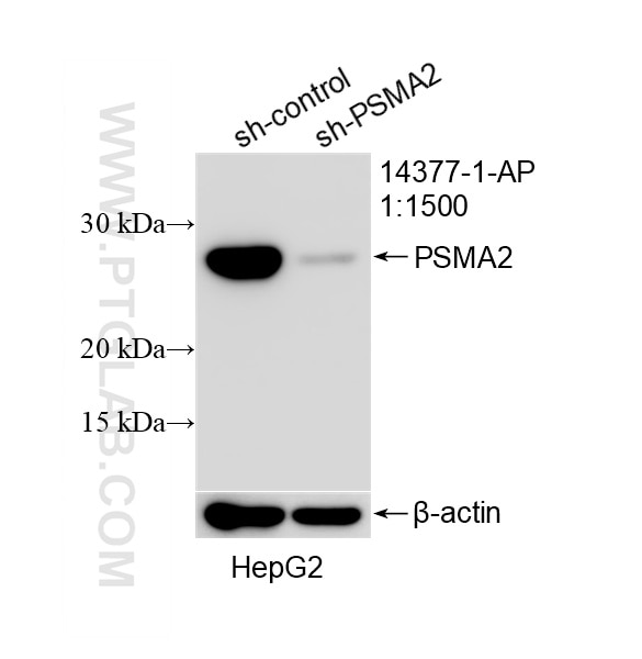 WB result of PSMA2 antibody (14377-1-AP; 1:1500; incubated at room temperature for 1.5 hours) with sh-Control and sh-PSMA2 transfected HepG2 cells. Western Blot (WB) analysis of HepG2 cells using PSMA2 Polyclonal antibody (14377-1-AP)