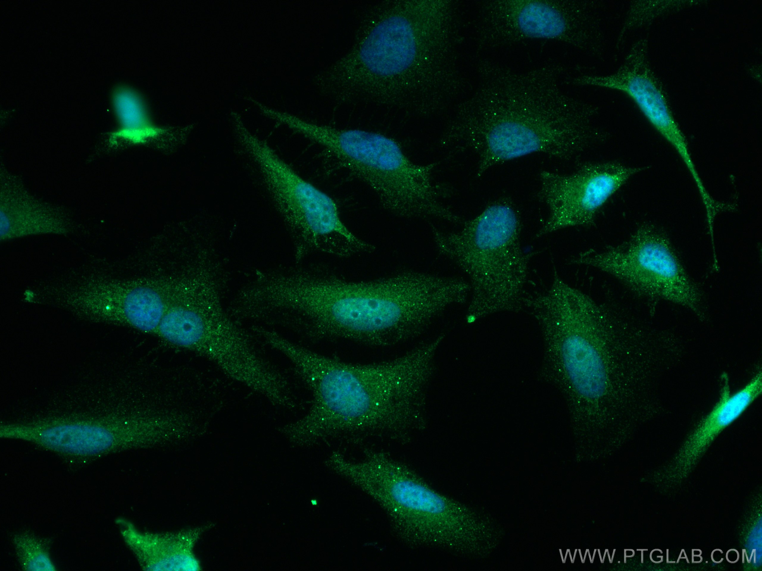 Immunofluorescence (IF) / fluorescent staining of HeLa cells using PSMA3 Polyclonal antibody (11887-1-AP)