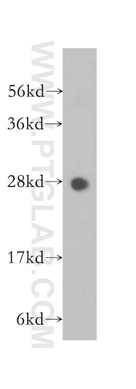 WB analysis of human lung using 11887-1-AP