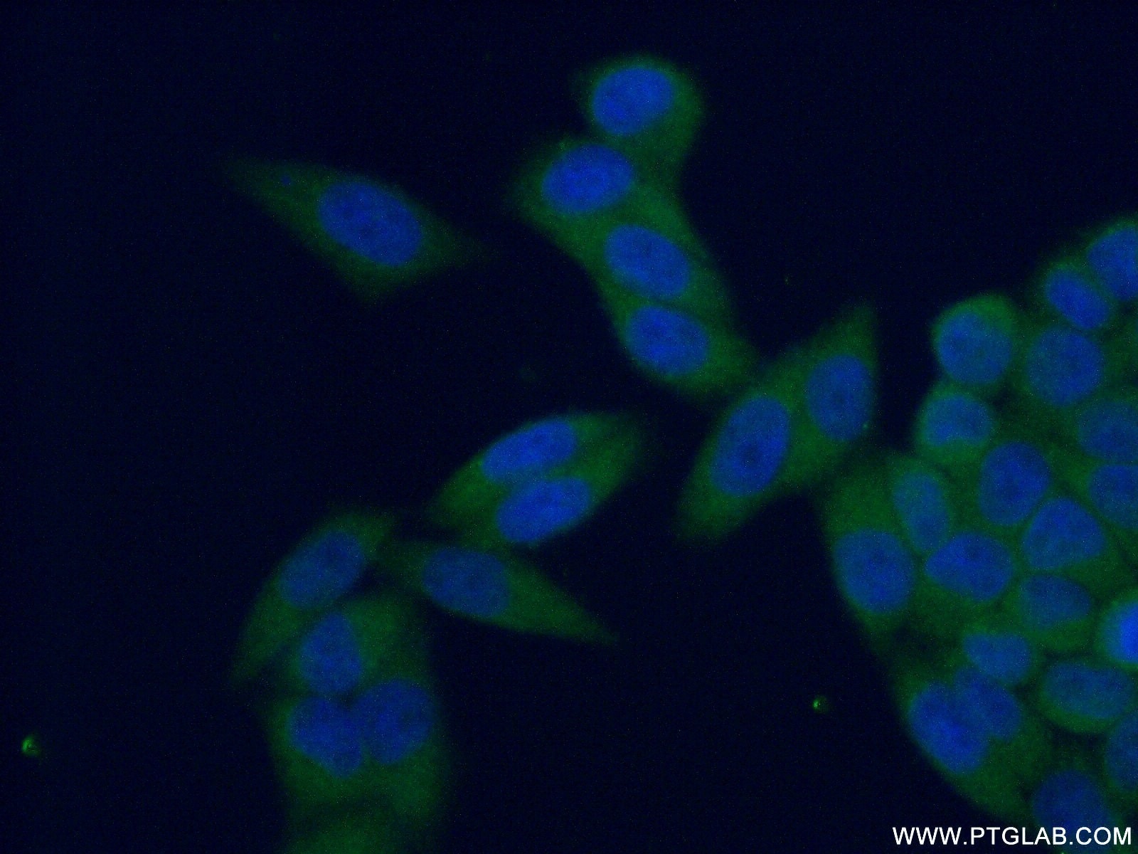 Immunofluorescence (IF) / fluorescent staining of HeLa cells using PSMA4 Polyclonal antibody (11943-2-AP)
