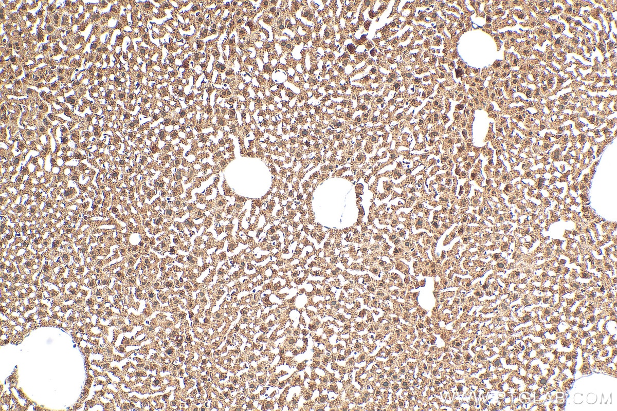 Immunohistochemistry (IHC) staining of mouse liver tissue using PSMA4 Polyclonal antibody (11943-2-AP)