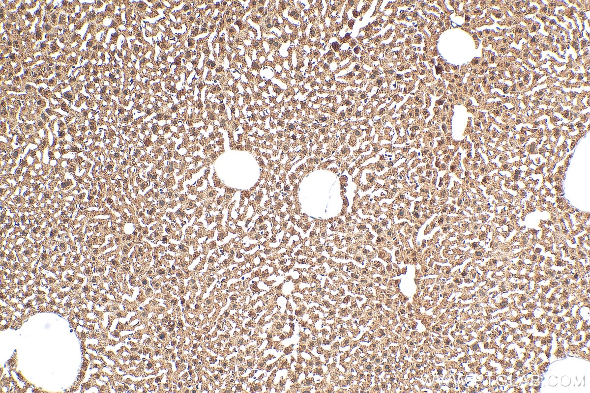 IHC staining of mouse liver using 11943-2-AP