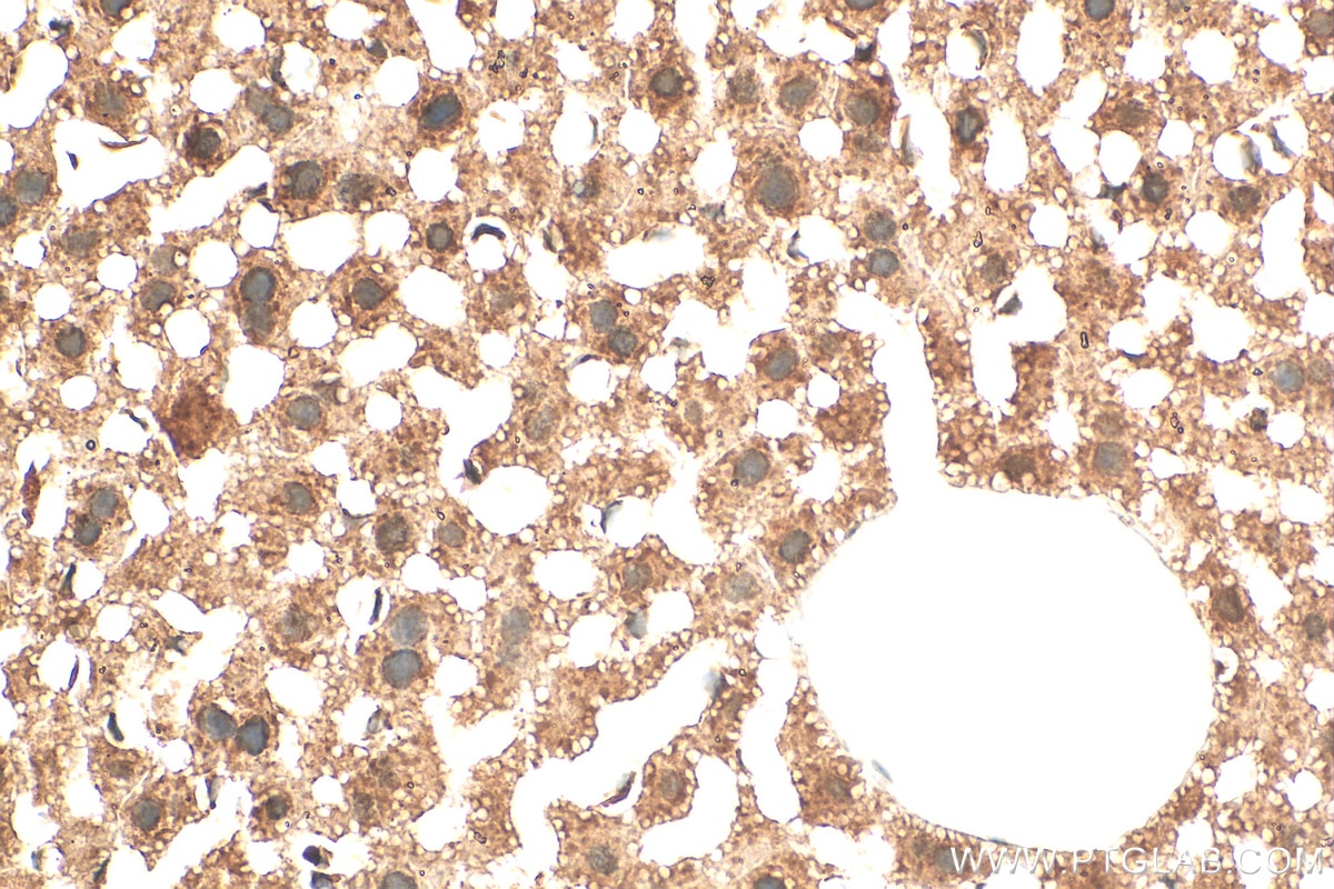 IHC staining of mouse liver using 11943-2-AP