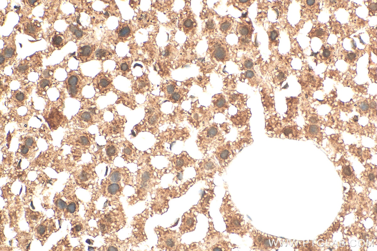 Immunohistochemistry (IHC) staining of mouse liver tissue using PSMA4 Polyclonal antibody (11943-2-AP)