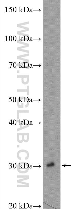 Western Blot (WB) analysis of mouse kidney tissue using PSMA4 Polyclonal antibody (11943-2-AP)