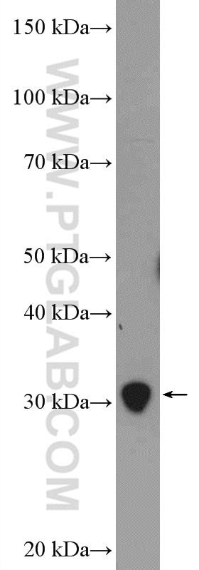 Western Blot (WB) analysis of mouse spleen tissue using PSMA4 Polyclonal antibody (11943-2-AP)