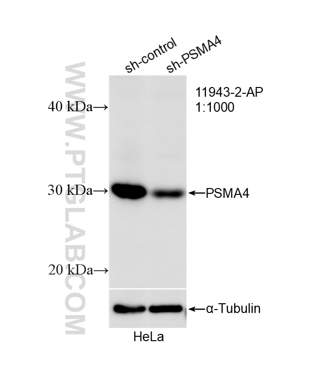 Western Blot (WB) analysis of HeLa cells using PSMA4 Polyclonal antibody (11943-2-AP)