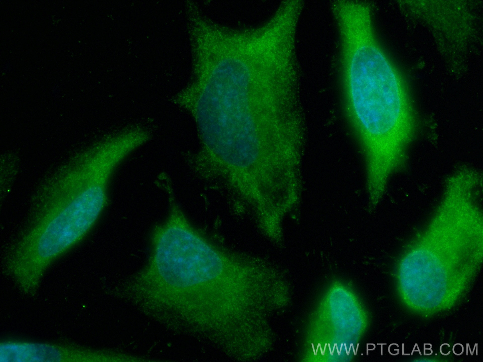 Immunofluorescence (IF) / fluorescent staining of HeLa cells using PSMA4 Monoclonal antibody (68203-1-Ig)