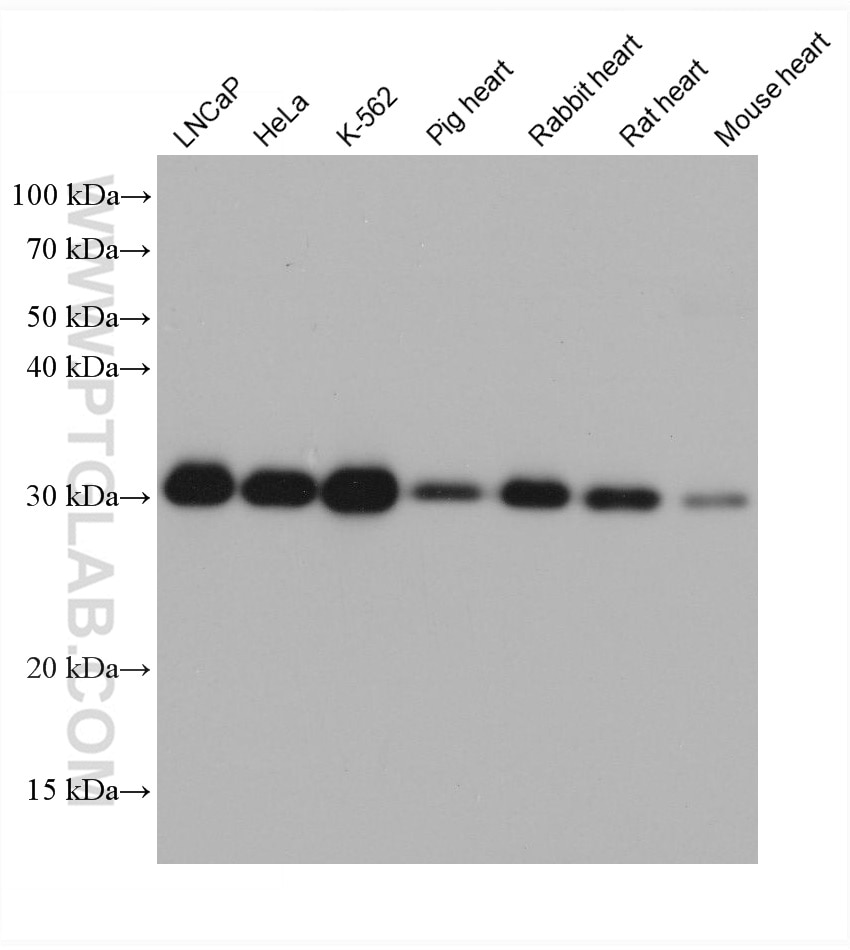 WB analysis using 68203-1-Ig