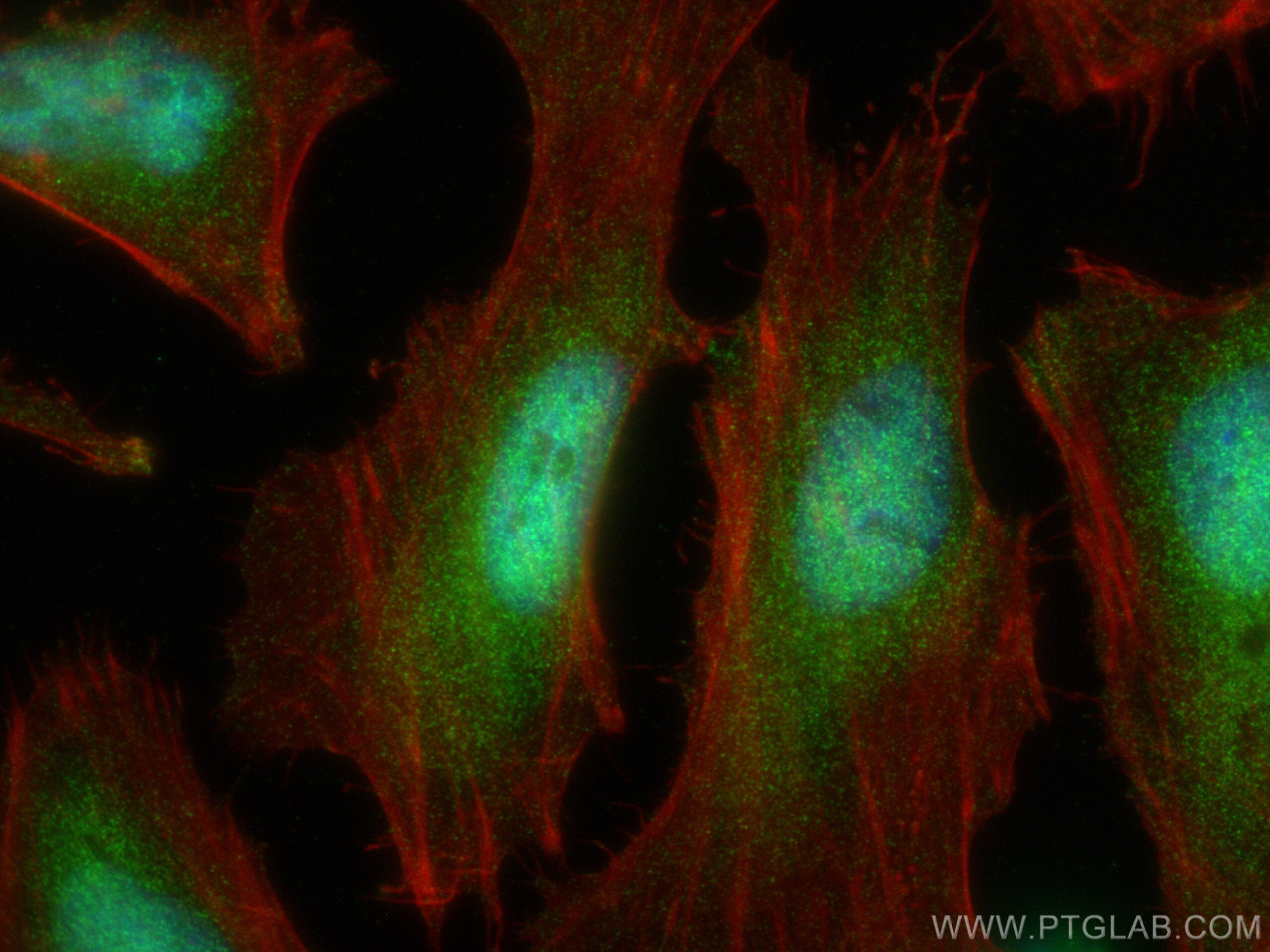 Immunofluorescence (IF) / fluorescent staining of HeLa cells using PSMA5 Polyclonal antibody (30580-1-AP)