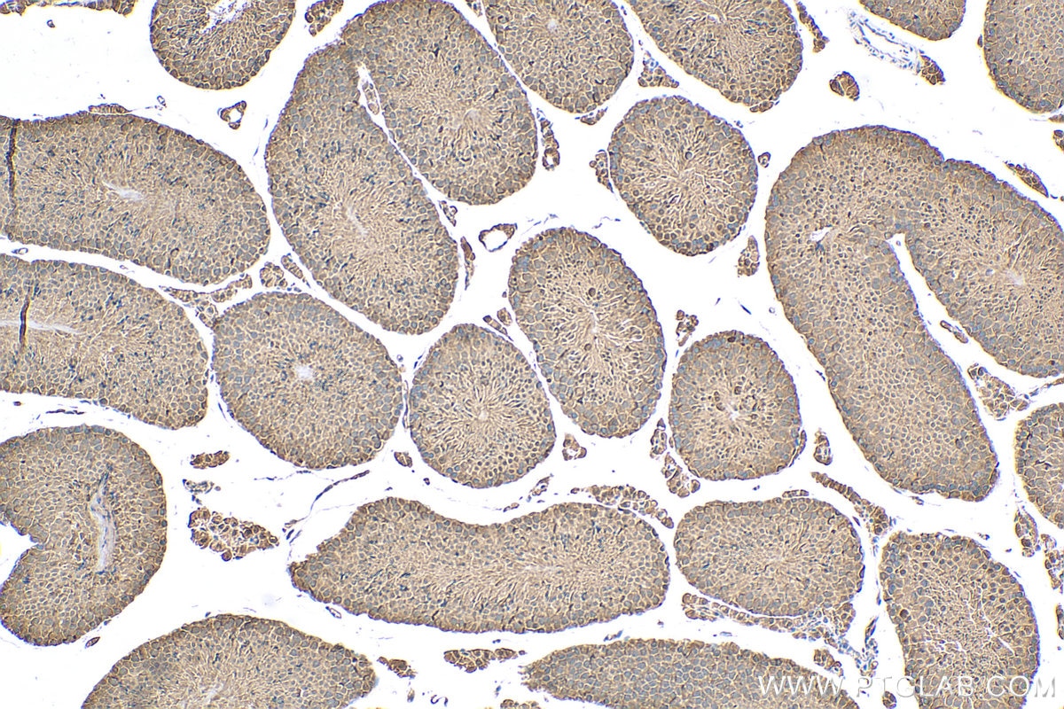 Immunohistochemistry (IHC) staining of mouse testis tissue using PSMA5 Polyclonal antibody (30580-1-AP)