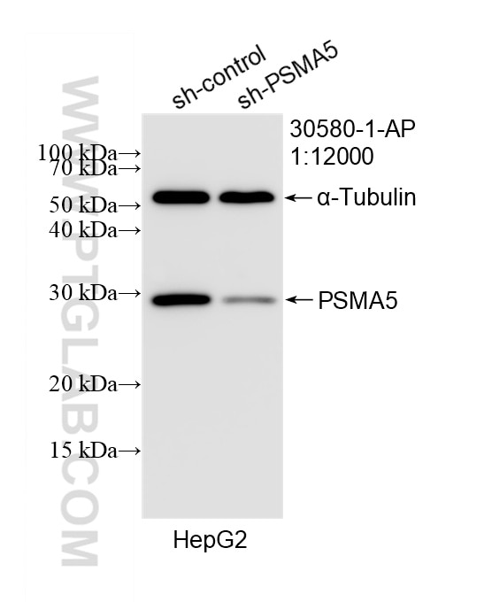 Western Blot (WB) analysis of HepG2 cells using PSMA5 Polyclonal antibody (30580-1-AP)