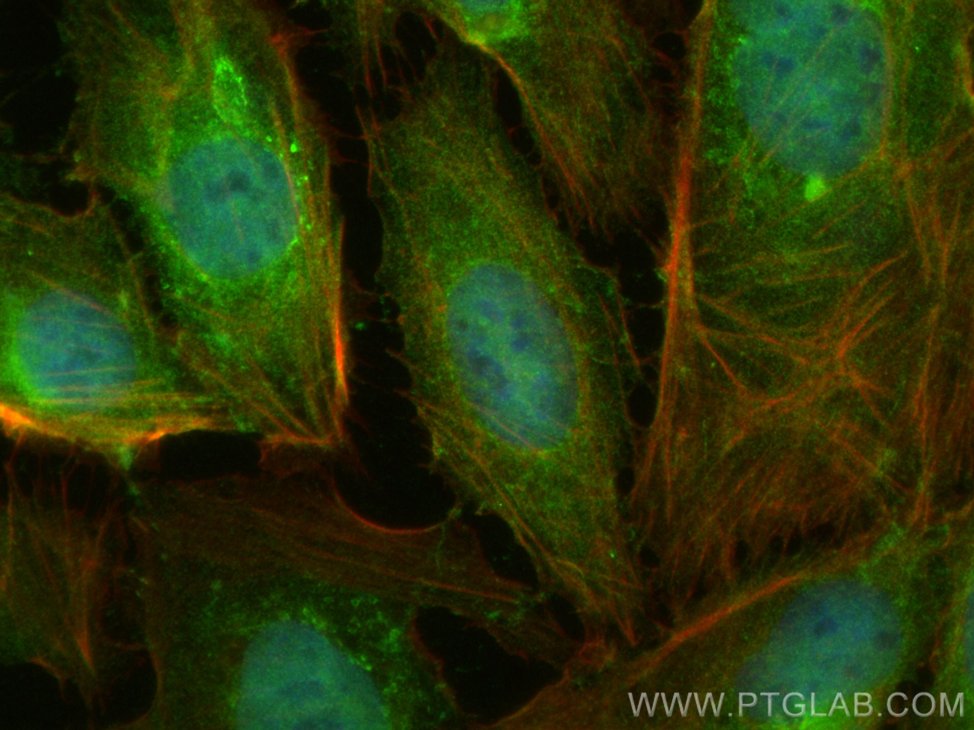 Immunofluorescence (IF) / fluorescent staining of U2OS cells using PSMA5 Polyclonal antibody (31384-1-AP)