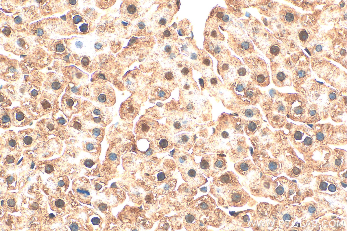 Immunohistochemistry (IHC) staining of rat liver tissue using PSMA5 Polyclonal antibody (31384-1-AP)