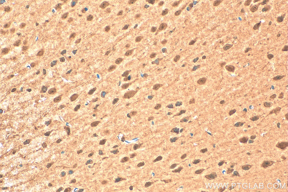 Immunohistochemistry (IHC) staining of mouse brain tissue using PSMA5 Polyclonal antibody (31384-1-AP)