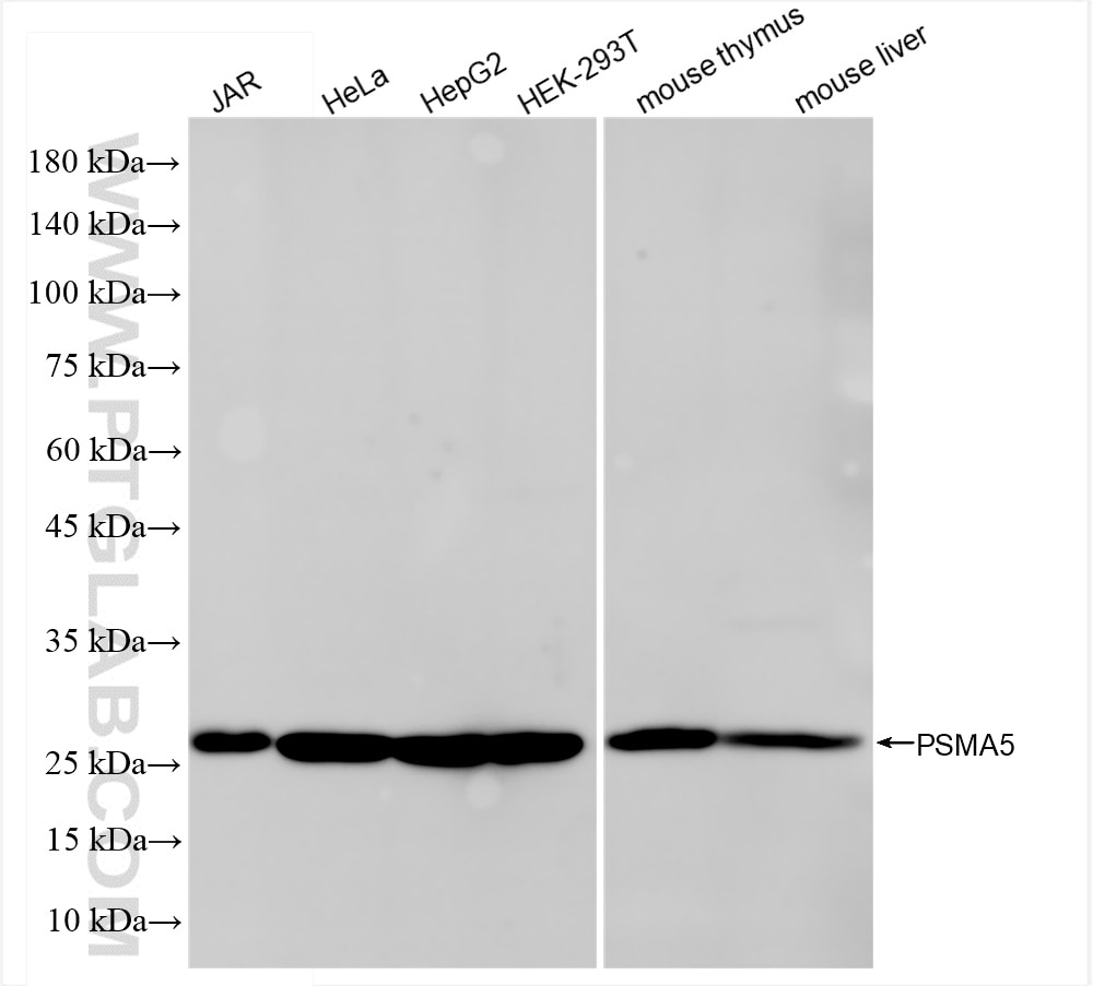 Western Blot (WB) analysis of various lysates using PSMA5 Recombinant antibody (84424-1-RR)