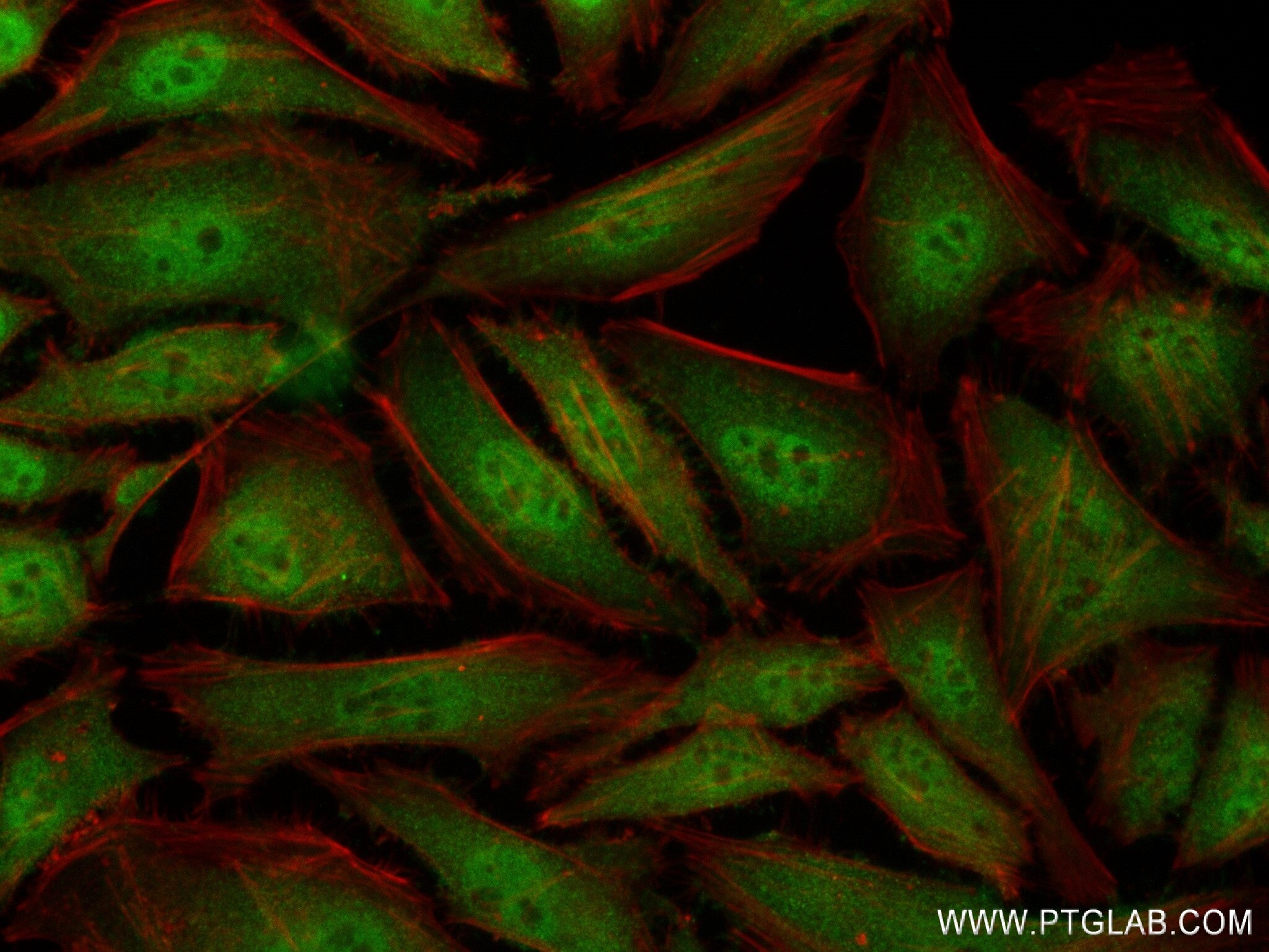 Immunofluorescence (IF) / fluorescent staining of HeLa cells using PSMA5 Recombinant antibody (84424-4-RR)