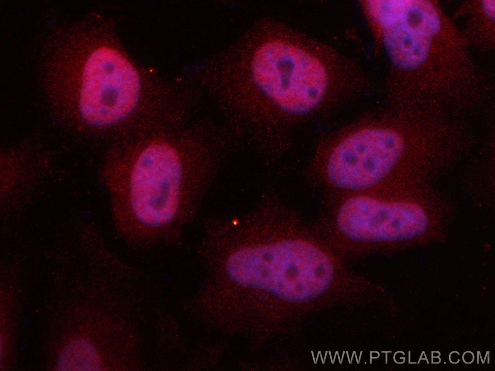 Immunofluorescence (IF) / fluorescent staining of HeLa cells using PSMA5 Recombinant antibody (84424-4-RR)