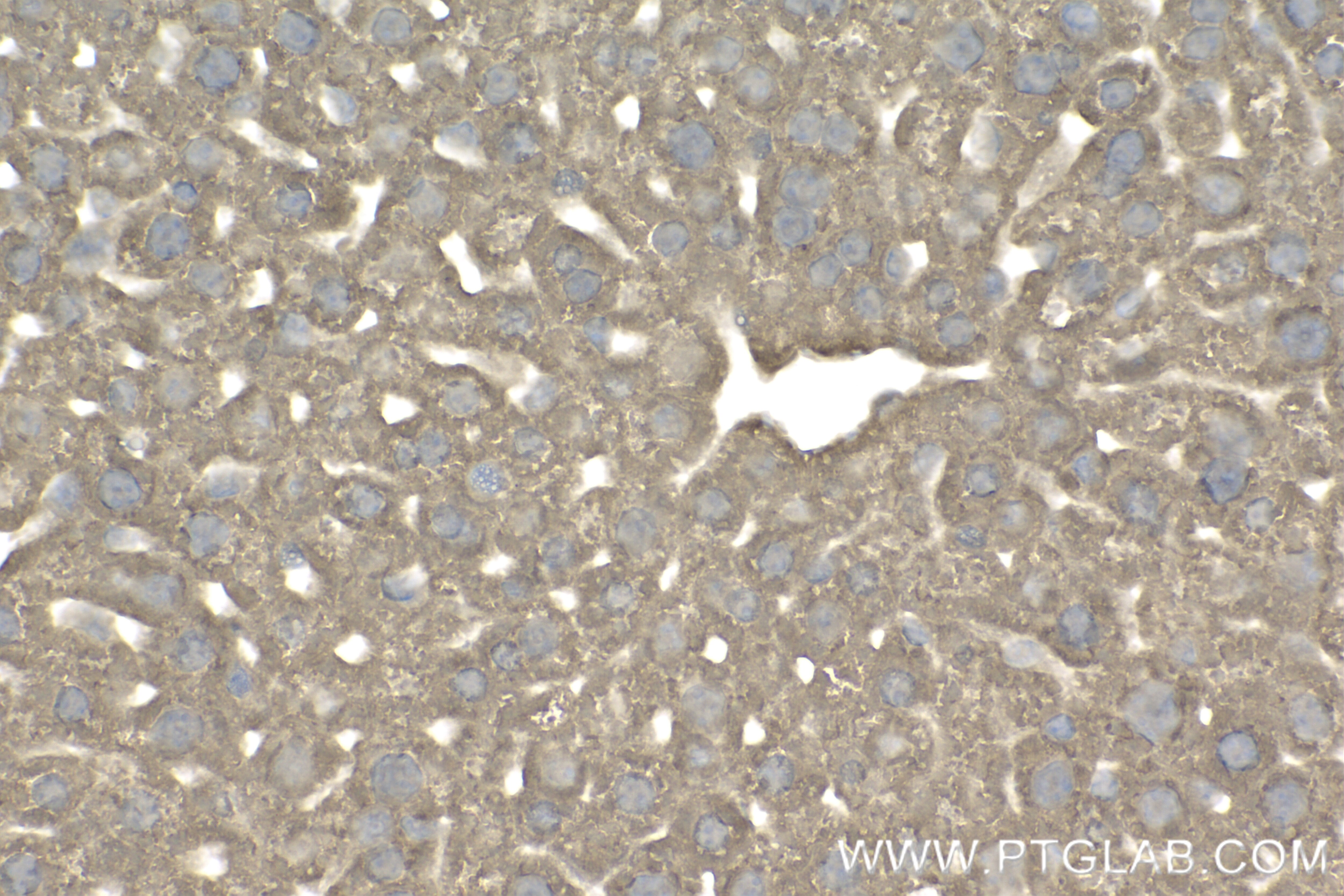 Immunohistochemistry (IHC) staining of mouse liver tissue using PSMA5 Recombinant antibody (84424-4-RR)