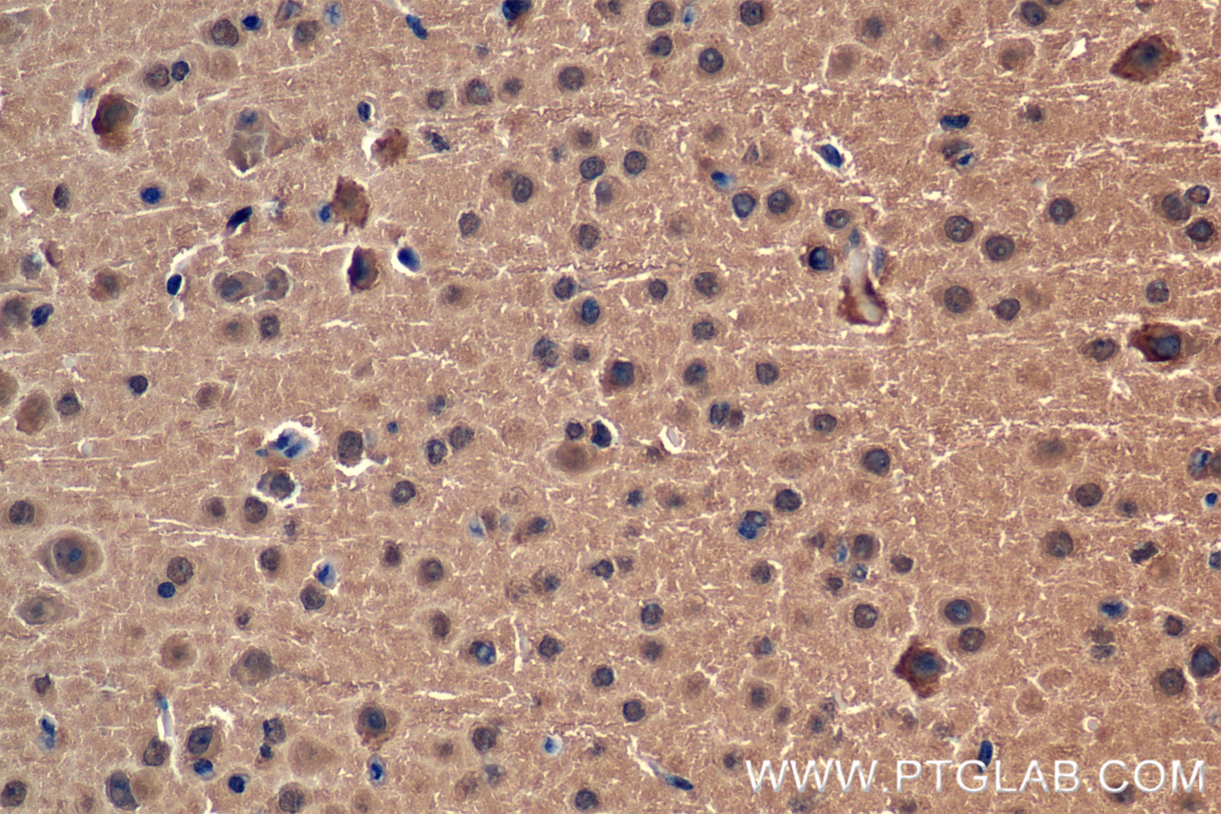 Immunohistochemistry (IHC) staining of mouse brain tissue using PSMA5 Recombinant antibody (84424-4-RR)
