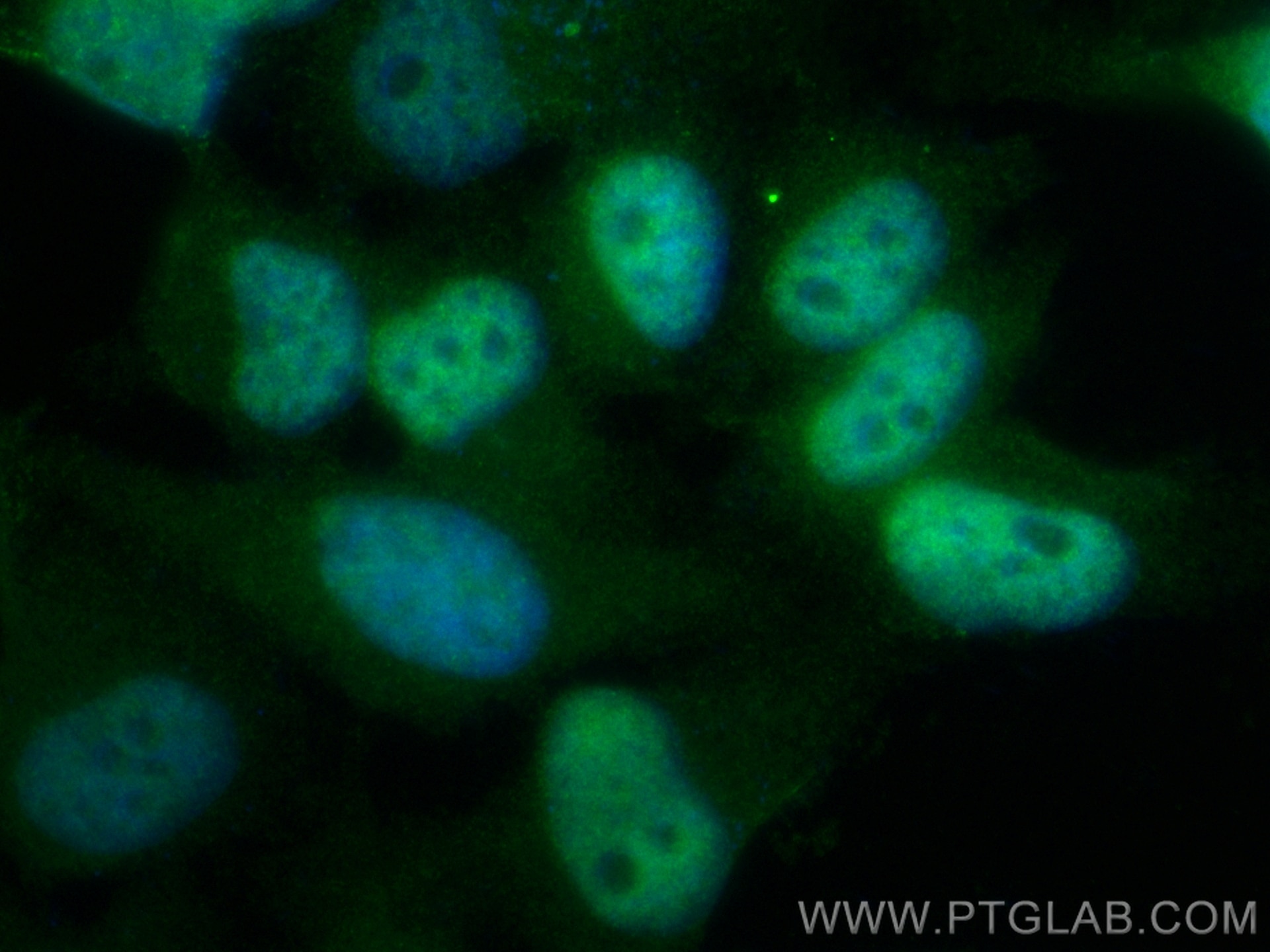 Immunofluorescence (IF) / fluorescent staining of HeLa cells using CoraLite® Plus 488-conjugated PSMA5 Recombinant an (CL488-84424-4)