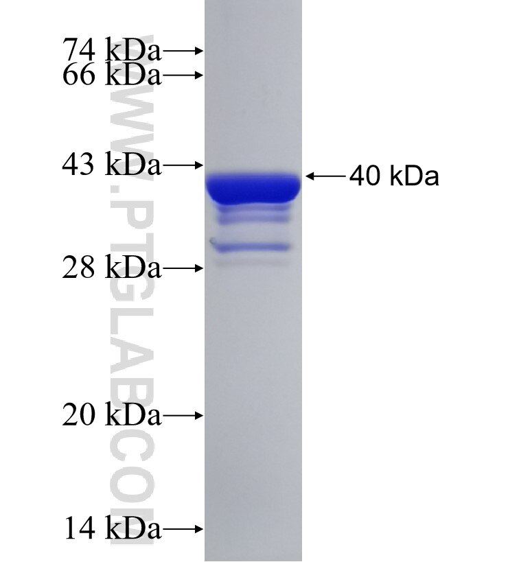 PSMA5 fusion protein Ag30703 SDS-PAGE