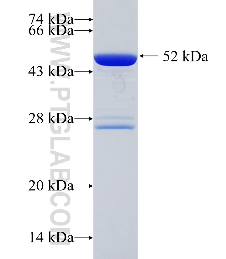 PSMA5 fusion protein Ag34928 SDS-PAGE