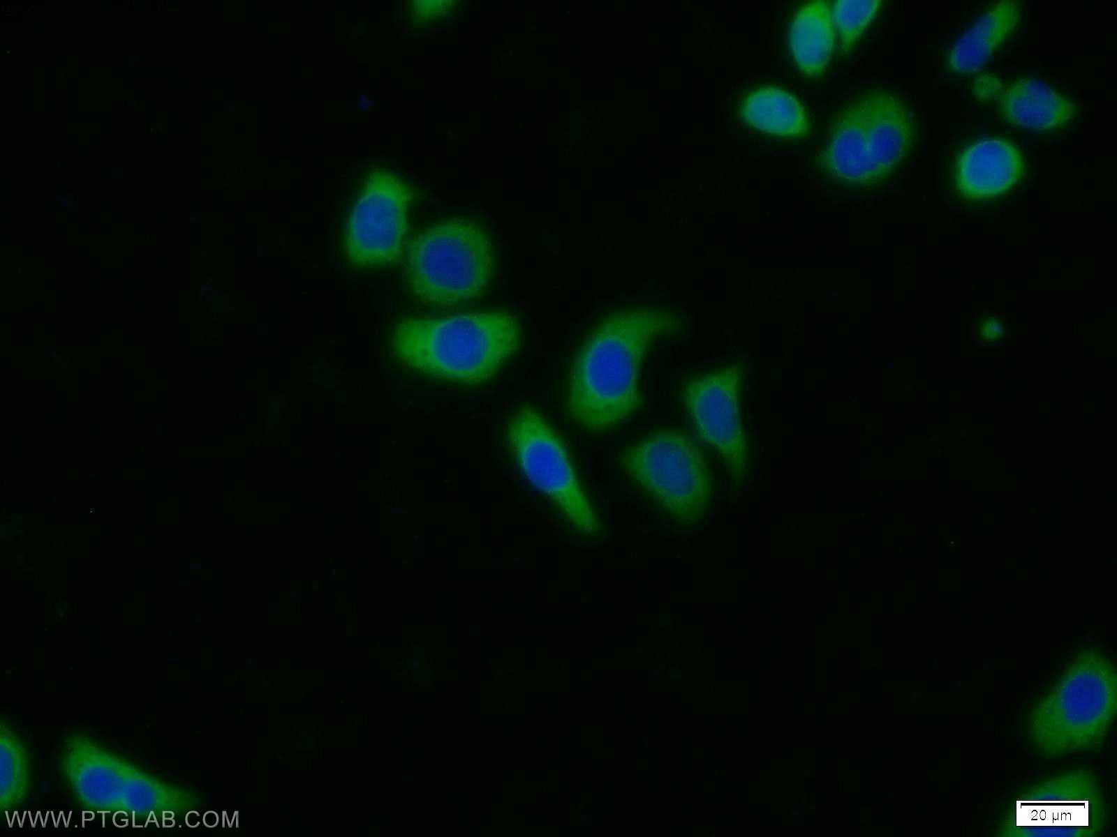 Immunofluorescence (IF) / fluorescent staining of MCF-7 cells using PSMA6 Polyclonal antibody (11573-1-AP)