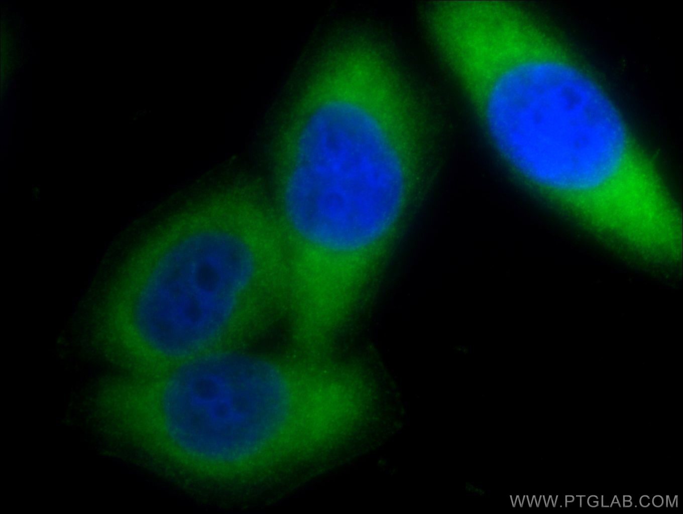 Immunofluorescence (IF) / fluorescent staining of HeLa cells using PSMA6 Polyclonal antibody (11573-1-AP)