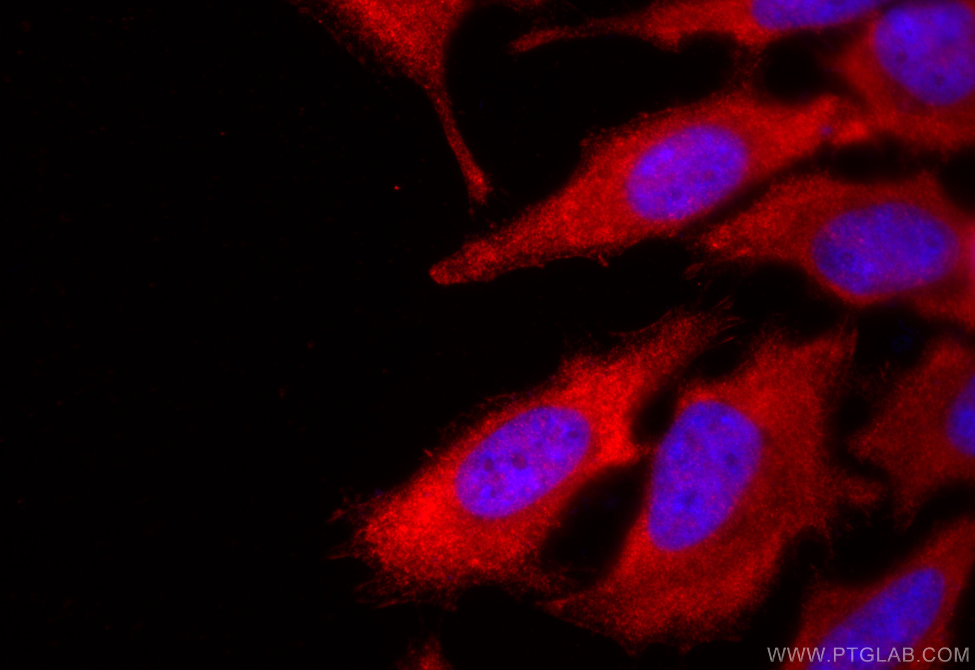 Immunofluorescence (IF) / fluorescent staining of HeLa cells using PSMA6 Polyclonal antibody (11573-1-AP)